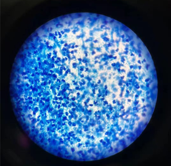 肺炎链球菌革兰染色图片
